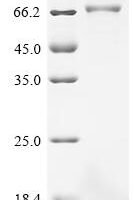 Human Butyrophilin-like protein 2 (BTNL2), partial Recombinant Protein, C-hFc1, aa 141–457 - BioCrest Sci