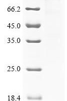 Human Caprin-1 (CAPRIN1) Recombinant Protein, N-10His, aa 2–709, Mammalian cell - BioCrest Sci