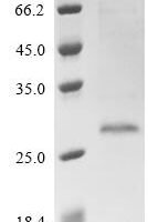 Macaca fascicularis Ubiquitin carboxyl-terminal hydrolase isozyme L1(UCHL1), partial Recombinant Protein - BioCrest Sci