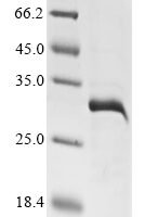 Plasmodium falciparum Reticulocyte-binding protein PFD0110w (PFD0110w), partial Recombinant Protein - BioCrest Sci