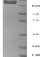 Human Phosphoglucomutase-1 (PGM1) Recombinant Protein - BioCrest Sci