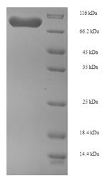 Human Phosphoglucomutase-1 (PGM1) Recombinant Protein, Homo sapiens (Human), E.coli, N-terminal 6xHis-SUMO-tagged, 77.4 kDa, purity >≥ 90% as determined by SDS-PAGE.