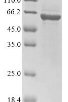 Rat Nuclear pore glycoprotein p62 (Nup62) Recombinant Protein, N-His - BioCrest Sci