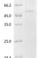 Human Fibulin-7 (FBLN7) Recombinant Protein, C-His, aa 25–439, Baculovirus - BioCrest Sci