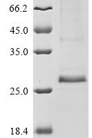 Human Protein RD3 (RD3) Recombinant Protein - BioCrest Sci