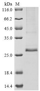Human Protein RD3 (RD3) Recombinant Protein, Homo sapiens (Human), Mammalian cell, C-terminal 9xHis-tagged, 25.3 kDa, purity >≥ 85% as determined by SDS-PAGE.