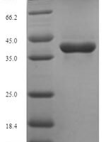 Mycobacterium tuberculosis Thymidylate kinase (tmk) Recombinant Protein - BioCrest Sci