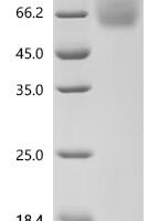 Macaca fascicularis carcinoembryonic antigen-related cell adhesion molecule 1 isoform X1 (CEACAM1), partial Recombinant Protein - BioCrest Sci