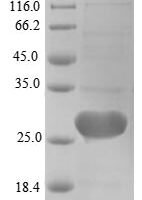 Human cDNA FLJ56323, highly similar to Methylated-DNA--protein-cysteinemethyltransferase (EC 2.1.1.63), partial Recombinant Protein - BioCrest Sci