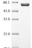Human Receptor-interacting serine/threonine-protein kinase 2 (RIPK2) Recombinant Protein, C-His - BioCrest Sci