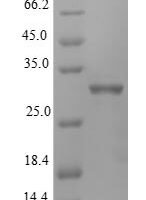 Rat Insulin-like growth factor-binding protein 1 (Igfbp1) Recombinant Protein, N-His - BioCrest Sci