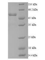 Human Dynactin subunit 4 (DCTN4) Recombinant Protein - BioCrest Sci