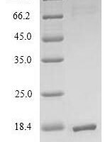 Escherichia coli Thioredoxin-2 (trxC) Recombinant Protein, N-His - BioCrest Sci