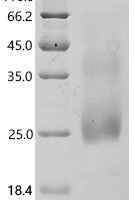 Mouse Oncostatin-M (Osm) Recombinant Protein, N-His, aa 25–206, Yeast - BioCrest Sci