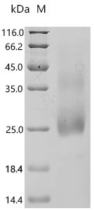 Mouse Oncostatin-M (Osm) Recombinant Protein, N-His, aa 25–206, Yeast, Mus musculus (Mouse), Yeast, N-terminal 6xHis-tagged, 22.1 kDa, purity >≥ 95% as determined by SDS-PAGE.