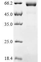 Human Calcium/calmodulin-dependent protein kinase type II subunit delta (CAMK2D) Recombinant Protein - BioCrest Sci