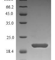 Saccharomyces cerevisiae Nucleoside diphosphate kinase (YNK1) Recombinant Protein, N-10His/C-Myc - BioCrest Sci
