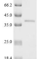 Human immunodeficiency virus type 1 group M subtype G Protein Vpr (vpr) Recombinant Protein - BioCrest Sci