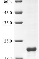 Human Urocortin-3 (UCN3) Recombinant Protein - BioCrest Sci
