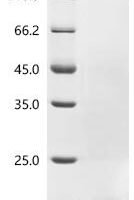 Human Platelet factor 4 (PF4) Recombinant Protein, N-His - BioCrest Sci