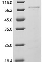 Agaricus bisporus Polyphenol oxidase 3 (PPO3) Recombinant Protein - BioCrest Sci