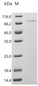 Agaricus bisporus Polyphenol oxidase 3 (PPO3) Recombinant Protein, Agaricus bisporus (White button mushroom), E.coli, C-terminal 6xHis-tagged, 52.3 kDa, purity >≥ 95% as determined by SDS-PAGE.