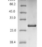 Human Immunoglobulin iota chain (VPREB1) Recombinant Protein - BioCrest Sci