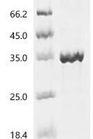Human Orexin receptor type 2 (HCRTR2), partial Recombinant Protein, C-hFc1 - BioCrest Sci