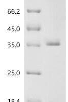 Human Epithelial cell adhesion molecule (EPCAM), partial Recombinant Protein - BioCrest Sci