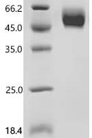 Human Beta-2-glycoprotein 1 (APOH) Recombinant Protein - BioCrest Sci