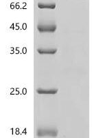 Human Transcription factor PU.1 (SPI1), Biotinylated Recombinant Protein - BioCrest Sci