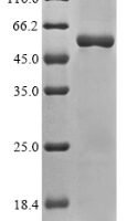 Rat Sodium/potassium-transporting ATPase subunit alpha-3 (Atp1a3), partial Recombinant Protein - BioCrest Sci