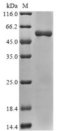 Rat Sodium/potassium-transporting ATPase subunit alpha-3 (Atp1a3), partial Recombinant Protein, Rattus norvegicus (Rat), E.coli, N-terminal 10xHis-tagged and C-terminal Myc-tagged, 54.6 kDa, purity >≥ 85% as determined by SDS-PAGE.