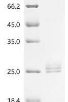 Rat Interleukin-11 (Il11) Recombinant Protein, N-10His - BioCrest Sci