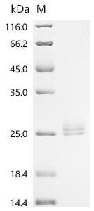 Rat Interleukin-11 (Il11) Recombinant Protein, N-10His, Rattus norvegicus (Rat), Mammalian cell, N-terminal 10xHis-tagged, 22.8 kDa, purity >≥ 95% as determined by SDS-PAGE.