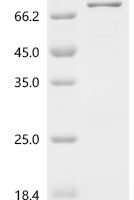 Human Myc proto-oncogene protein (MYC) Recombinant Protein, N-His-IF2DI - BioCrest Sci