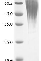 Human Putative teratocarcinoma-derived growth factor 3 (TDGF1P3), partial Recombinant Protein - BioCrest Sci