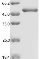Human Eukaryotic translation initiation factor 4E (EIF4E) (S209D) Recombinant Protein, N-GST - BioCrest Sci