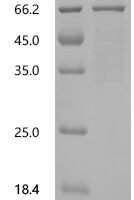 Human DNA oxidative demethylase ALKBH2 (ALKBH2) Recombinant Protein, C-GST - BioCrest Sci