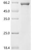 Alteromonas macleodii Iota-carrageenase (cgiA) Recombinant Protein - BioCrest Sci
