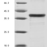 Mouse Tenomodulin (Tnmd), partial Recombinant Protein - BioCrest Sci