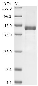 Human Complement factor I (CFI), partial Recombinant Protein, Homo sapiens (Human), E.coli, N-terminal 10xHis-GST-tagged and C-terminal Myc-tagged, 43.4 kDa, purity >≥ 85% as determined by SDS-PAGE.