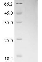 Heteroscodra maculata Delta-theraphotoxin-Hm1a Recombinant Protein, N-10His/C-Myc - BioCrest Sci