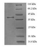 Human Corticotropin-releasing factor receptor 1 (CRHR1), partial Recombinant Protein, N-GST - BioCrest Sci