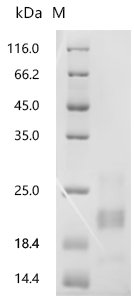 Mouse Interferon gamma (Ifng) Recombinant Protein, C-10His, aa 23–155, Mammalian cell, Mus musculus (Mouse), Mammalian cell, C-terminal 10xHis-tagged, 16.9 kDa, purity >≥ 95% as determined by SDS-PAGE.