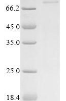 Human Catenin beta-1 (CTNNB1) Recombinant Protein, N-His, aa 2–781, Yeast - BioCrest Sci