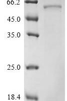 Rat Glucose-6-phosphate isomerase (Gpi) Recombinant Protein - BioCrest Sci