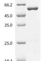 Human Kinesin-1 heavy chain (KIF5B), partial Recombinant Protein, C-His - BioCrest Sci