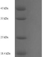 Human Peptidyl-prolyl cis-trans isomerase-like 4 (PPIL4) Recombinant Protein - BioCrest Sci