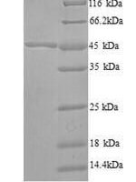 Bacillus subtilis 3-oxoacyl-[acyl-carrier-protein] synthase 2 (fabF) Recombinant Protein, N-His, aa 1–413, Yeast - BioCrest Sci